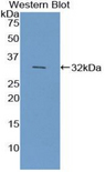 CYP7A1 Antibody - Western blot of recombinant CYP7A1.  This image was taken for the unconjugated form of this product. Other forms have not been tested.