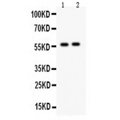 CYP7A1 Antibody - CYP7A1 antibody Western blot. All lanes: Anti CYP7A1 at 0.5 ug/ml. Lane 1: Rat Liver Tissue Lysate at 50 ug. Lane 2: Mouse Liver Tissue Lysate at 50 ug. Predicted band size: 58 kD. Observed band size: 58 kD.