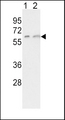 CYP7A1 Antibody - Western blot of CYP7A1 Antibody in K562(lane 1), HepG2(lane 2) cell line lysates (35 ug/lane). CYP7A1 (arrow) was detected using the purified antibody.
