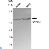 CYP7A1 Antibody - Western Blot (WB) analysis using CYP7A1 Monoclonal Antibody against Jurkat, K562 cell lysate.