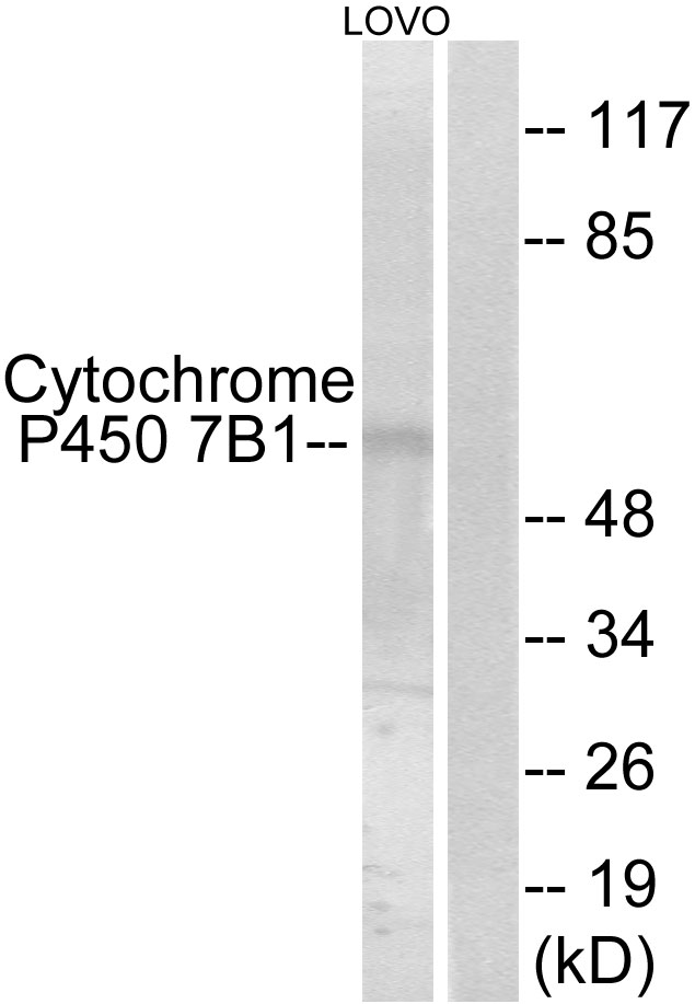 CYP7B1 Antibody - Western blot analysis of lysates from LOVO cells, using Cytochrome P450 7B1 Antibody. The lane on the right is blocked with the synthesized peptide.