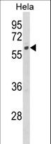 CYP7B1 Antibody - Western blot of CYP7B1 Antibody in HeLa cell line lysates (35 ug/lane). CYP7B1 (arrow) was detected using the purified antibody.