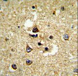 CYP7B1 Antibody - Formalin-fixed and paraffin-embedded human brain tissue reacted with CYP7B1 Antibody , which was peroxidase-conjugated to the secondary antibody, followed by DAB staining. This data demonstrates the use of this antibody for immunohistochemistry; clinical relevance has not been evaluated.