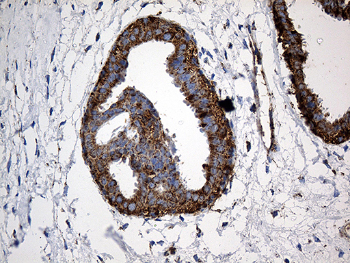 CYP7B1 Antibody - Immunohistochemical staining of paraffin-embedded Human breast tissue within the normal limits using anti-CYP7B1 mouse monoclonal antibody. (Heat-induced epitope retrieval by 1mM EDTA in 10mM Tris buffer. (pH8.5) at 120°C for 3 min. (1:500)