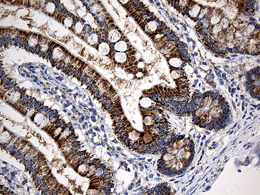 CYP7B1 Antibody - Immunohistochemical staining of paraffin-embedded Human colon tissue within the normal limits using anti-CYP7B1 mouse monoclonal antibody. (Heat-induced epitope retrieval by 1mM EDTA in 10mM Tris buffer. (pH8.5) at 120°C for 3 min. (1:500)