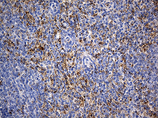 CYP7B1 Antibody - Immunohistochemical staining of paraffin-embedded Human spleen tissue within the normal limits using anti-CYP7B1 mouse monoclonal antibody. (Heat-induced epitope retrieval by 1mM EDTA in 10mM Tris buffer. (pH8.5) at 120°C for 3 min. (1:500)