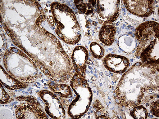 CYP7B1 Antibody - Immunohistochemical staining of paraffin-embedded Human Kidney tissue within the normal limits using anti-CYP7B1 mouse monoclonal antibody. (Heat-induced epitope retrieval by 1mM EDTA in 10mM Tris buffer. (pH8.5) at 120°C for 3 min. (1:500)