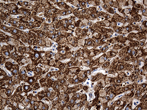 CYP7B1 Antibody - Immunohistochemical staining of paraffin-embedded Human liver tissue within the normal limits using anti-CYP7B1 mouse monoclonal antibody. (Heat-induced epitope retrieval by 1mM EDTA in 10mM Tris buffer. (pH8.5) at 120°C for 3 min. (1:500)
