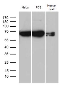 CYP7B1 Antibody - Western blot analysis of extracts. (35ug) from 2 cell lines and human brain tissue lysate by using anti-CYP7B1 monoclonal antibody. (1:500)