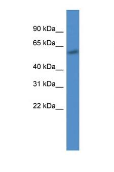CYP7B1 Antibody - CYP7B1 antibody Western blot of 721_B Cell lysate. Antibody concentration 1 ug/ml.  This image was taken for the unconjugated form of this product. Other forms have not been tested.