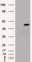 CYP7B1 Antibody - HEK293T cells were transfected with the pCMV6-ENTRY control (Left lane) or pCMV6-ENTRY cyp7b1 (Right lane) cDNA for 48 hrs and lysed. Equivalent amounts of cell lysates (5 ug per lane) were separated by SDS-PAGE and immunoblotted with anti-cyp7b1.