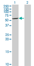 CYP7B1 Antibody - Western blot of CYP7B1 expression in transfected 293T cell line by CYP7B1 monoclonal antibody (M06), clone 2B11.