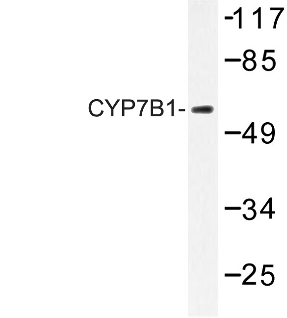 CYP7B1 Antibody - Western blot of CYP7B1 (Q127) pAb in extracts from LOVO cells.