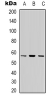 CYP7B1 Antibody - Western blot analysis of Cytochrome P450 7B1 expression in HeLa (A); A549 (B); MCF7 (C) whole cell lysates.