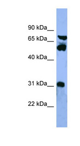 CYP8B1 Antibody - CYP8B1 antibody Western blot of HepG2 cell lysate.  This image was taken for the unconjugated form of this product. Other forms have not been tested.