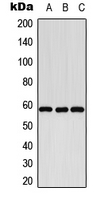 CYP8B1 Antibody - Western blot analysis of Cytochrome P450 8B1 expression in K562 (A); SP2/0 (B); PC12 (C) whole cell lysates.