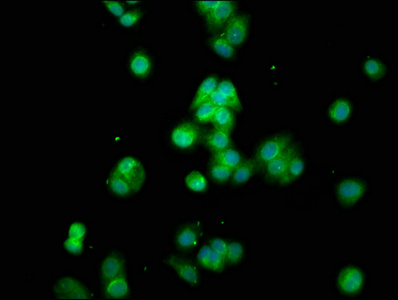 CYP8B1 Antibody - Immunofluorescence staining of HepG2 cells at a dilution of 1:100, counter-stained with DAPI. The cells were fixed in 4% formaldehyde, permeabilized using 0.2% Triton X-100 and blocked in 10% normal Goat Serum. The cells were then incubated with the antibody overnight at 4°C.The secondary antibody was Alexa Fluor 488-congugated AffiniPure Goat Anti-Rabbit IgG (H+L) .