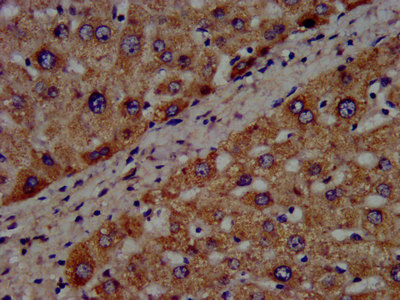CYP8B1 Antibody - Immunohistochemistry image at a dilution of 1:300 and staining in paraffin-embedded human liver tissue performed on a Leica BondTM system. After dewaxing and hydration, antigen retrieval was mediated by high pressure in a citrate buffer (pH 6.0) . Section was blocked with 10% normal goat serum 30min at RT. Then primary antibody (1% BSA) was incubated at 4 °C overnight. The primary is detected by a biotinylated secondary antibody and visualized using an HRP conjugated SP system.