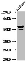 CYP8B1 Antibody - Positive Western Blot detected in Rat kidney tissue. All lanes: CYP8B1 antibody at 6.4 µg/ml Secondary Goat polyclonal to rabbit IgG at 1/50000 dilution. Predicted band size: 59 KDa. Observed band size: 59 KDa