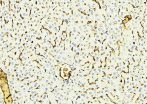 CYP8B1 Antibody - 1:100 staining mouse liver tissue by IHC-P. The sample was formaldehyde fixed and a heat mediated antigen retrieval step in citrate buffer was performed. The sample was then blocked and incubated with the antibody for 1.5 hours at 22°C. An HRP conjugated goat anti-rabbit antibody was used as the secondary.