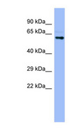 CYPIVA22 / CYP4A22 Antibody - CYP4A22 antibody Western blot of Fetal Stomach lysate. This image was taken for the unconjugated form of this product. Other forms have not been tested.