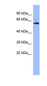 CYPIVA22 / CYP4A22 Antibody - CYP4A22 antibody Western blot of Fetal Stomach lysate. This image was taken for the unconjugated form of this product. Other forms have not been tested.