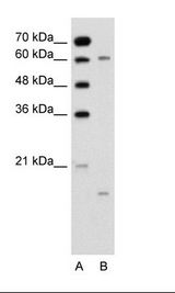 CYPIVA22 / CYP4A22 Antibody - A: Marker, B: Jurkat Cell Lysate.  This image was taken for the unconjugated form of this product. Other forms have not been tested.