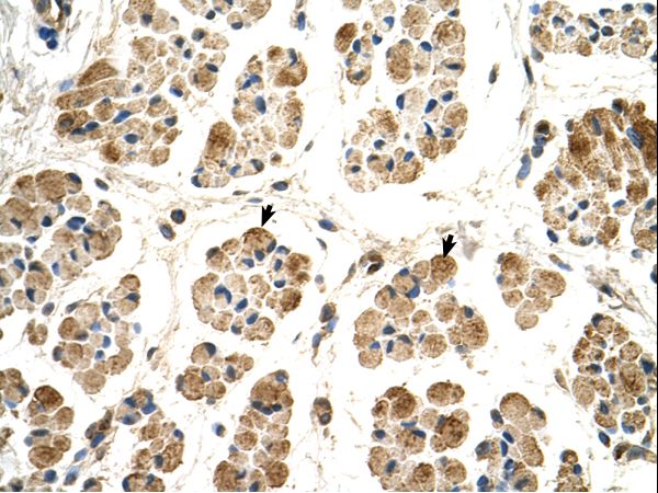 CYPOR / POR Antibody - POR / CYPOR antibody POR(P450 (cytochrome) oxidoreductase) Antibody was used in IHC to stain formalin-fixed, paraffin-embedded human muscle.  This image was taken for the unconjugated form of this product. Other forms have not been tested.