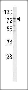 CYPOR / POR Antibody - Western blot of P450R antibody in K562 cell line lysates (35 ug/lane). P450R (arrow) was detected using the purified antibody.