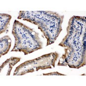 CYPOR / POR Antibody - POR antibody IHC-paraffin. IHC(P): Mouse Intestine Tissue.