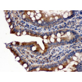 CYPOR / POR Antibody - POR antibody IHC-paraffin. IHC(P): Rat Intestine Tissue.