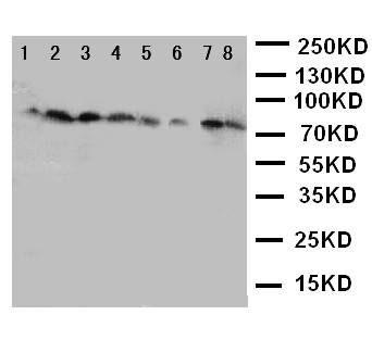 CYPOR / POR Antibody - WB of CYPOR / POR antibody. Lane 1: Rat Ovary Tissue Lysate. Lane 2: Rat Lung Tissue Lysate. Lane 3: Rat Testis Tissue Lysate. Lane 4: Rat Spleen Tissue Lysate. Lane 5: A549 Cell Lysate. Lane 6: HELA Cell Lysate. Lane 7: SKOV Cell Lysate. Lane 8: MCF-7 Cell Lysate.