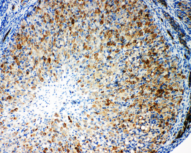 CYPOR / POR Antibody - CYPOR / POR antibody. IHC(P): Rat Ovary Tissue.