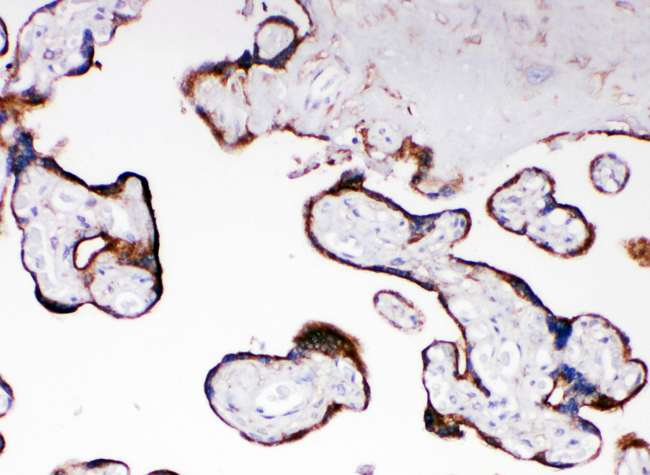 CYPOR / POR Antibody - CYPOR / POR antibody. IHC(P): Human Placenta Tissue.