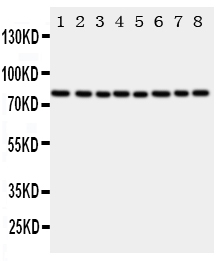 CYPOR / POR Antibody - Anti-POR antibody, Western blotting Lane 1: Rat Ovary Tissue LysateLane 2: Rat Lung Tissue LysateLane 3: Rat Testis Tissue LysateLane 4: Rat Spleen Tissue LysateLane 5: A549 Cell Lysate Lane 6: HELA Cell LysateLane 7: SKOV Cell LysateLane 8: MCF-7 Cell Lysate