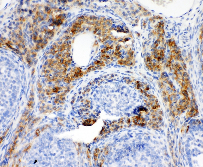 CYPOR / POR Antibody - IHC analysis of POR using anti-POR antibody. POR was detected in paraffin-embedded section of rat ovary tissue. Heat mediated antigen retrieval was performed in citrate buffer (pH6, epitope retrieval solution) for 20 mins. The tissue section was blocked with 10% goat serum. The tissue section was then incubated with 1µg/ml rabbit anti-POR antibody overnight at 4°C. Biotinylated goat anti-rabbit IgG was used as secondary antibody and incubated for 30 minutes at 37°C. The tissue section was developed using Strepavidin-Biotin-Complex (SABC) with DAB as the chromogen.
