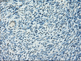 CYPOR / POR Antibody - Immunohistochemical staining of paraffin-embedded Ovary tissue using anti-POR mouse monoclonal antibody. (Dilution 1:50).