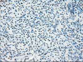 CYPOR / POR Antibody - Immunohistochemical staining of paraffin-embedded endometrium tissue using anti-POR mouse monoclonal antibody. (Dilution 1:50).