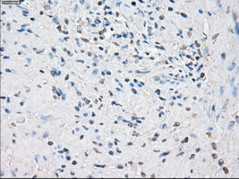 CYPOR / POR Antibody - Immunohistochemical staining of paraffin-embedded prostate tissue using anti-POR mouse monoclonal antibody. (Dilution 1:50).