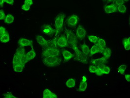 CYPOR / POR Antibody - Immunofluorescent staining of HT29 cells using anti-POR mouse monoclonal antibody.