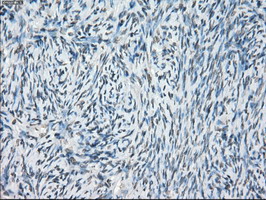 CYPOR / POR Antibody - IHC of paraffin-embedded Ovary tissue using anti-POR mouse monoclonal antibody. (Dilution 1:50).