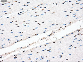 CYPOR / POR Antibody - IHC of paraffin-embedded colon tissue using anti-POR mouse monoclonal antibody. (Dilution 1:50).