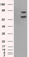 CYPOR / POR Antibody - HEK293T cells were transfected with the pCMV6-ENTRY control (Left lane) or pCMV6-ENTRY POR (Right lane) cDNA for 48 hrs and lysed. Equivalent amounts of cell lysates (5 ug per lane) were separated by SDS-PAGE and immunoblotted with anti-POR.