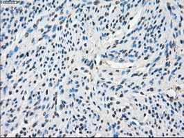CYPOR / POR Antibody - IHC of paraffin-embedded endometrium tissue using anti-POR mouse monoclonal antibody. (Dilution 1:50).