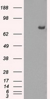 CYPOR / POR Antibody - HEK293T cells were transfected with the pCMV6-ENTRY control (Left lane) or pCMV6-ENTRY POR (Right lane) cDNA for 48 hrs and lysed. Equivalent amounts of cell lysates (5 ug per lane) were separated by SDS-PAGE and immunoblotted with anti-POR.