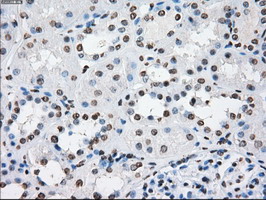CYPOR / POR Antibody - IHC of paraffin-embedded Kidney tissue using anti-POR mouse monoclonal antibody. (Dilution 1:50).