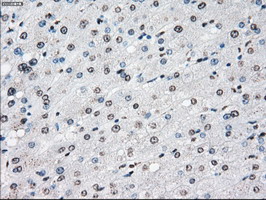CYPOR / POR Antibody - IHC of paraffin-embedded liver tissue using anti-POR mouse monoclonal antibody. (Dilution 1:50).