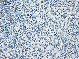 CYPOR / POR Antibody - IHC of paraffin-embedded Ovary tissue using anti-POR mouse monoclonal antibody. (Dilution 1:50).