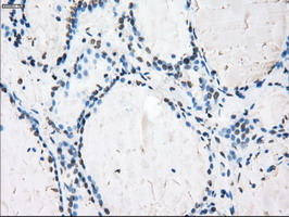 CYPOR / POR Antibody - IHC of paraffin-embedded thyroid tissue using anti-POR mouse monoclonal antibody. (Dilution 1:50).