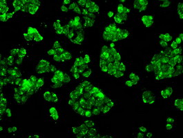 CYPOR / POR Antibody - Immunofluorescent staining of HT29 cells using anti-POR mouse monoclonal antibody.